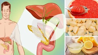 7 Alimentos para Limpar Naturalmente o Seu Fígado Gorduroso