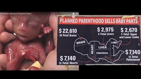 Satanic Planned Parenthood Selling Adrenochrome Baby Parts Since 2015! [12.09.2023]