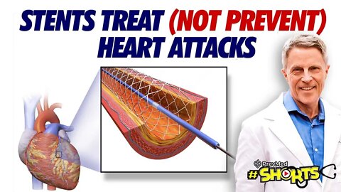 #SHORTS Stents Treat (But Don’t Prevent) Heart Attacks
