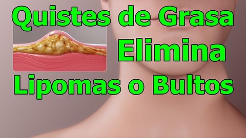 BINAURAL PARA DESHACER LIPOMAS BULTOS O QUISTES DE GRASA