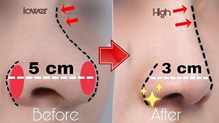Top Exercises For Nose | Practice it Every Day to Have a Perfect Beautiful Nose