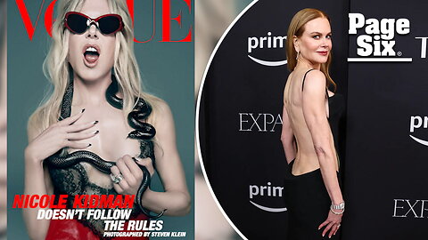 Nicole Kidman flaunts her figure — and holds a snake — in steamy lingerie shoot for Vogue Australia