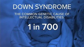 Buffalo Strong: What is Down Syndrome?
