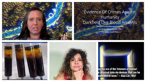 8/6/23 NEW discoveries in the Vax, flu shots, insulin, dental anaesthetics & more, shedding on the unvaxxed!