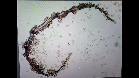 Graphenated Microfilariae Parasites Found in the Blood of the VAXXXed and UNVAXXXed