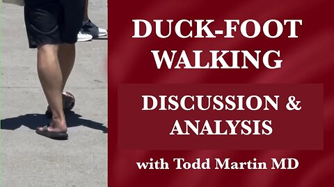 Duck Foot Walking and Anterior Pelvic Tilt Discussion and Analysis