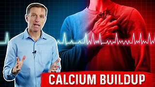 Arrhythmias Are Excess Calcium