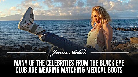 Many of the Celebrities from the Black Eye Club are wearing matching Medical Boots! 🎬