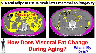 Visceral Fat Removal Extends Lifespan