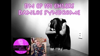 Deplorable Nation Ep 191 Ehlers Danlos Syndrome