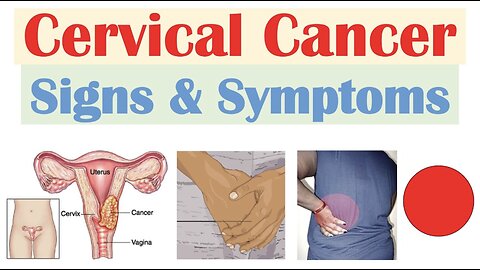 Cervical Cancer Signs & Symptoms (& Why They Occur)