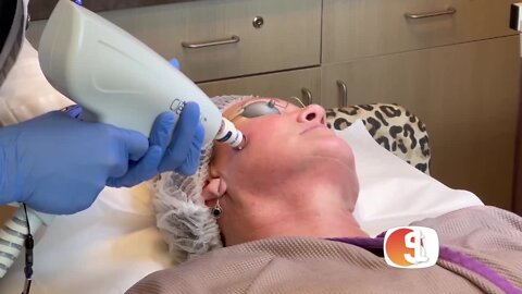 Face lift results without the downtime: Clear Lift at VitalityMDs Aesthetics