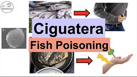 Ciguatera Fish Poisoning (Ciguatoxin) | Symptoms (Numb Feet, Diarrhea), Diagnosis, Treatment