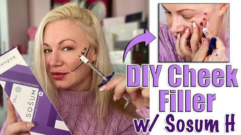 DIY Cheek Filler with Sosum H from Glamderma.com | Code Jessica10 Saves you Money!