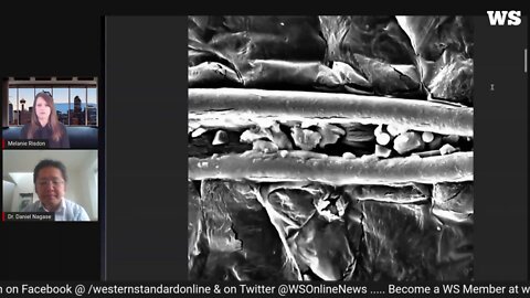 Dr. Daniel Nagase reveals advanced electron microscopy, compositional analysis of COVID jabs