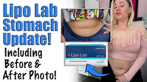 Lipo Lab Stomach Update! Including Before and After Photo| Code Jessica10 saves you Money at Vendors