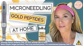 Microneedling Peptide Gold: Say Goodbye to Wrinkles & Dull Skin