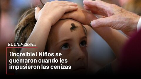 ¡Increíble! Niños se quemaron cuando les impusieron las cenizas