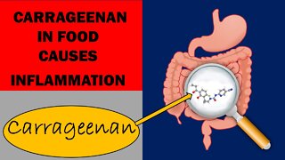 The Use of Carrageen in Food and Increased Rate of Inflammatory Bowel Diseases