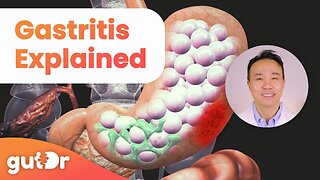 What is Gastritis? | The GutDr Explains (3D Gut Animation)