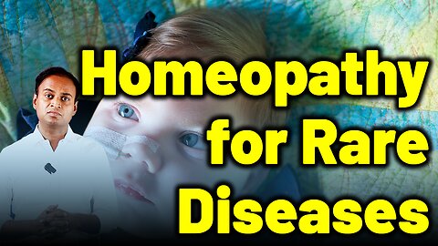 Homeopathy for Rare Diseases . | Dr. Bharadwaz | Homeopathy, Medicine & Surgery