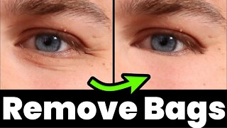 How To Remove Eye Bags In PhotoScape X!