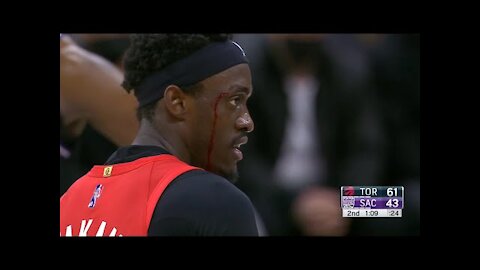 Pascal Siakam was bleeding from the head and the arena was playing bleeding love