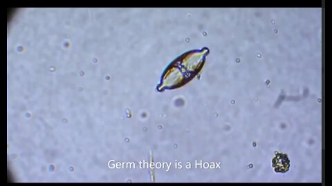 Germ theory is a hoax