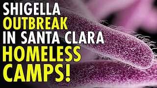 Shocking outbreak of Shigella in Santa Clara County homeless encampments