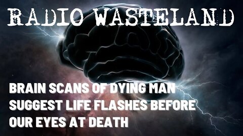 Brain Scans of Dying Man Suggest Life Flashes Before Our Eyes At Death