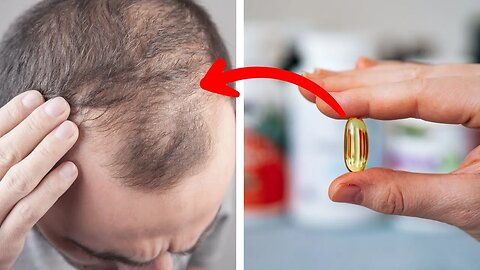 Are You Losing Your Hair? It Could Be a Vitamin Deficiency