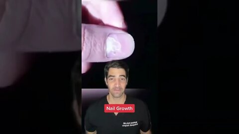 How Fast do Fingernails Grow