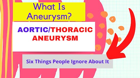 Aortic Aneurysm: Watch Out These Aortic Aneurysm Symptoms