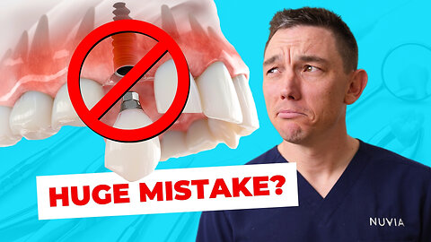 The 5 Reasons You Should NOT Get Dental Implants