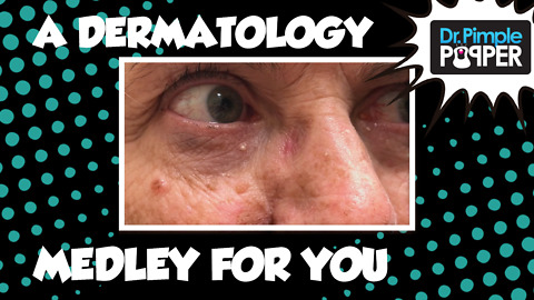 A Dermatology Medley for you!