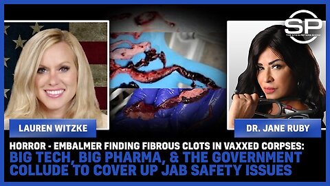 HORROR: Embalmer Finding Fibrous Clots In Vaxxed Corpses!