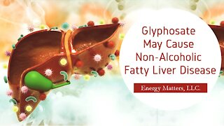 Glyphosate May Cause Non-Alcoholic Fatty Liver Disease!