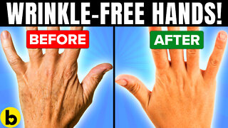 14 Best Home Remedies To Have Wrinkle-Free Hands