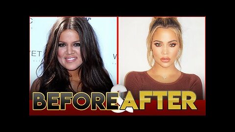 Khloe Kardashian | Before & After Transformation ( Fitness, Surgery, Pregnancy )