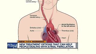 New options to prevent strokes in people with A-fib