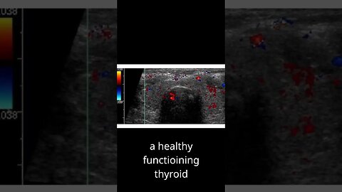 How to repair thyroid disorders?