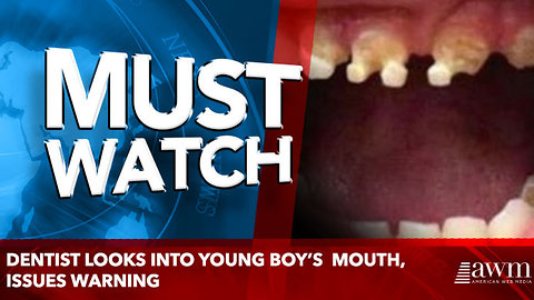 Dentist Looks Into young boy’s Mouth, Issues Warning