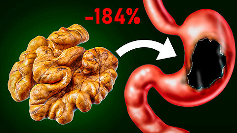 Walnuts are Highly Contraindicated for These People. What do Walnuts do?