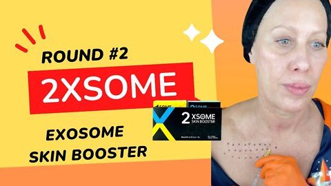 2XSOME Exosome Skin Booster Round #2 Estaderma 35% Sale SASSY35