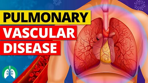 Pulmonary Vascular Disease (Medical Definition) | Quick Explainer Video