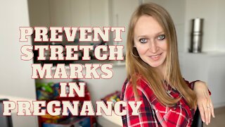 How to Prevent Stretch Marks in Pregnancy
