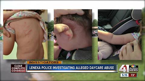 Lenexa PD investigating alleged day care abuse