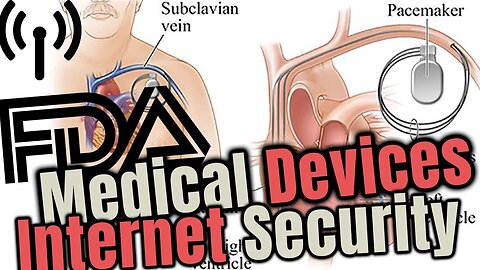 ⚕️FDA Warning Cyber Security Concerns on all Future Medical Device⚕️