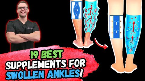 BEST 19 Supplements to FIX SWOLLEN Feet & Ankles!