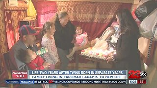 Life two years after twins born in separate years